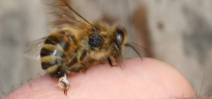 bee sting pain